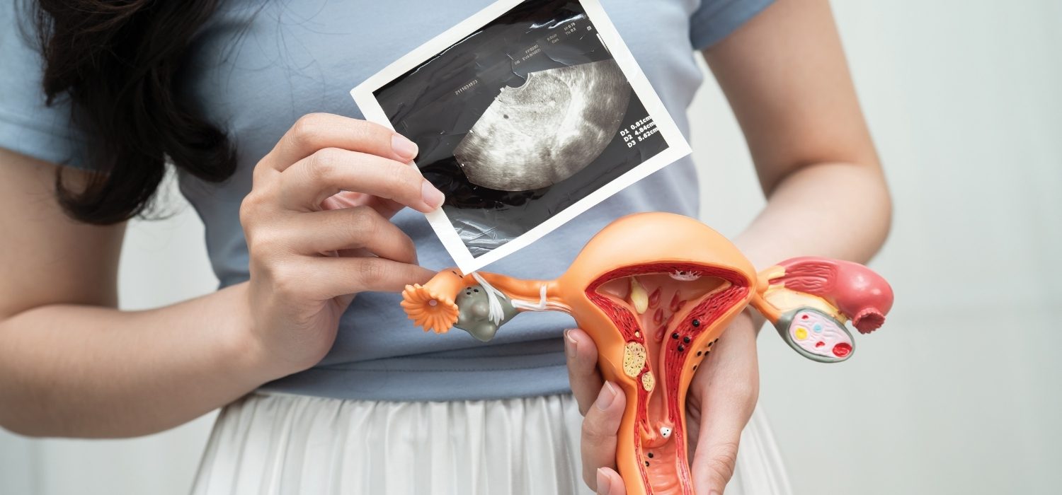 Navigating a septate uterus with pregnancy – what a doctor wants you to know