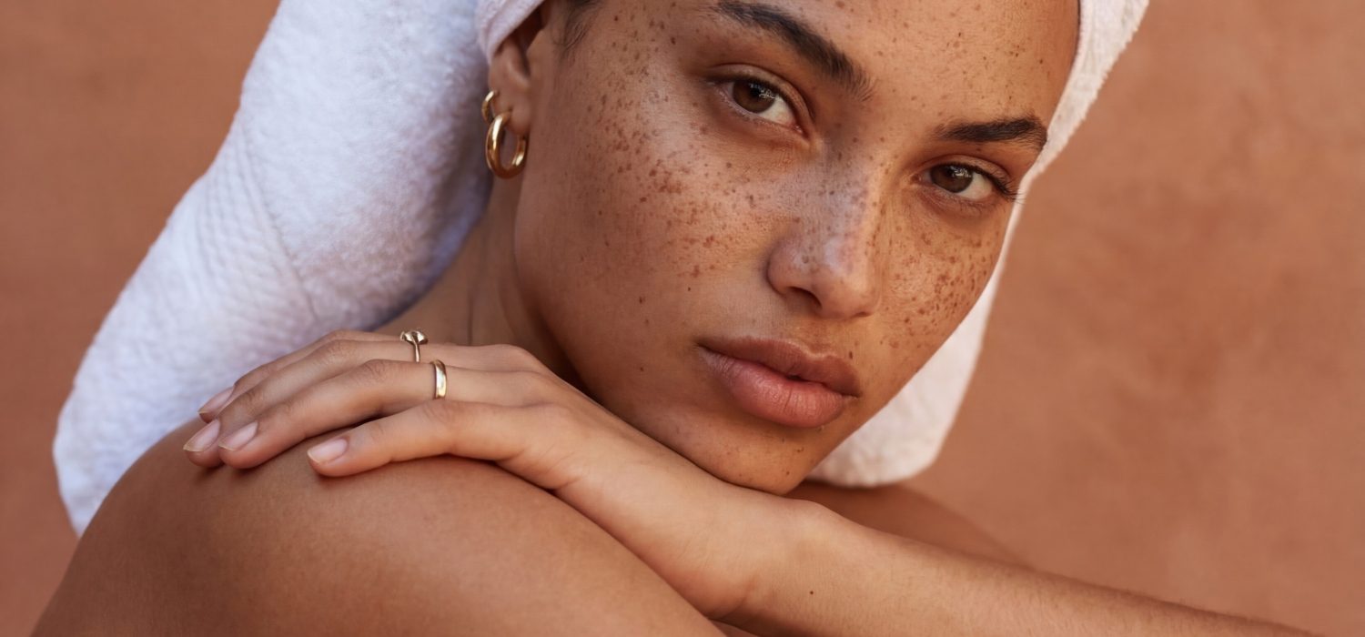 Moles vs freckles​ – here’s the difference (& how to spot when something’s not right)